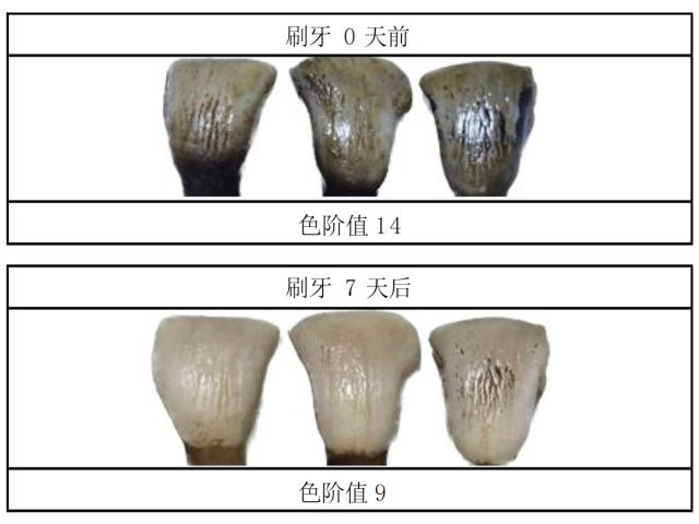 2026年三重专利牙膏怎么选？选购指南
